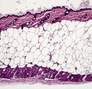 SubdermalFatInMousePurgedOfSenescentCells2012-03-10.jpg